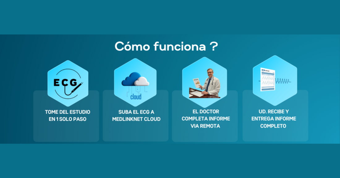 Cómo funciona la interpretación remota de ECG en la Red CardioSW