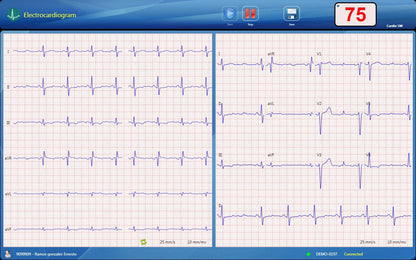 CardioSW - Rest ECG, Interpretation Software - Medical equipment / Equipo medico - Mediventa USA