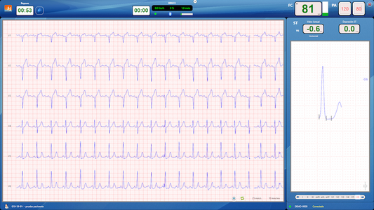 Programa CardioSW Stress Test - Mediventa México