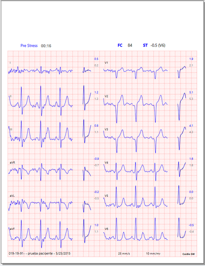 ECG Cardioview CV1200