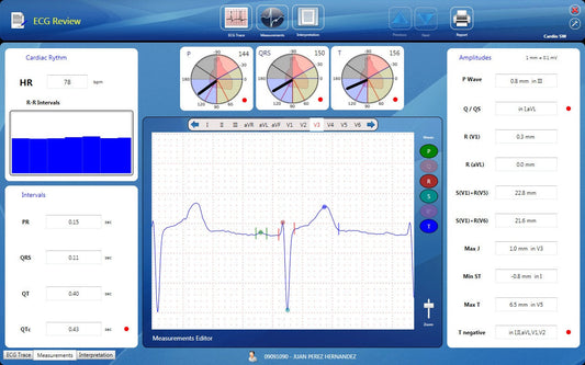 Programa CardioSW Rest ECG, pantalla de mediciones automáticas - Mediventa México