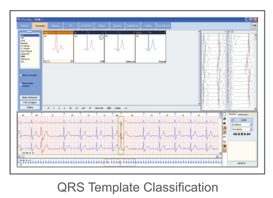 Programa CardioSW Holter, clasificación automática de morfologías QRS - Mediventa México